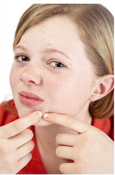 Como se livrar das espinhas da acne